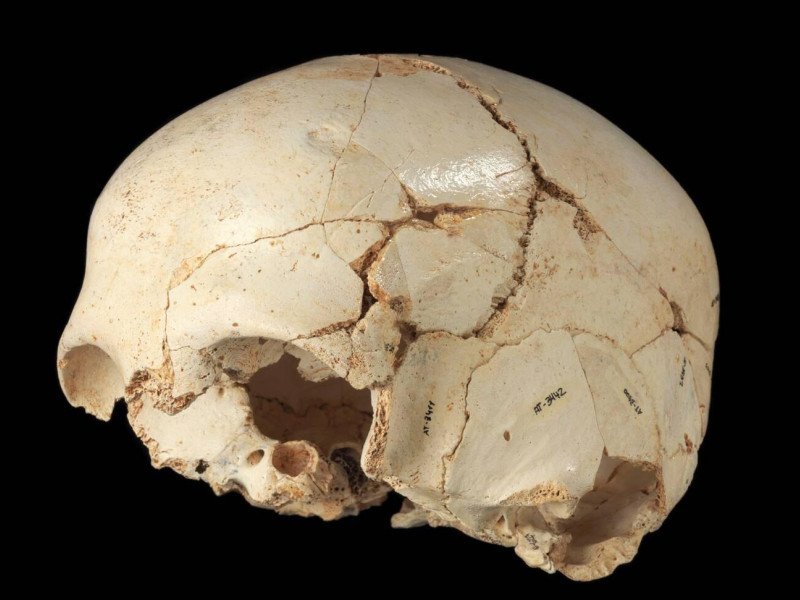 El primer enfermo de la historia estaba en Burgos: Benjamina en Atapuerca