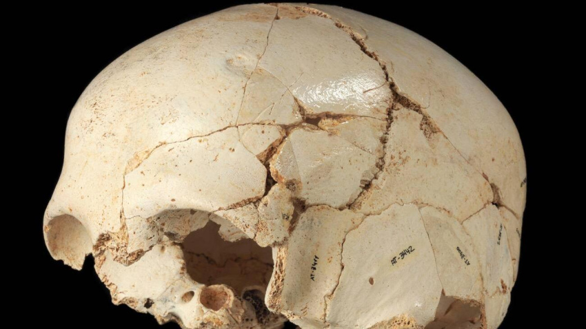 El primer enfermo de la historia estaba en Burgos: Benjamina en Atapuerca