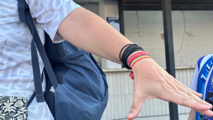 Una mujer muestra una picadura de avispa.