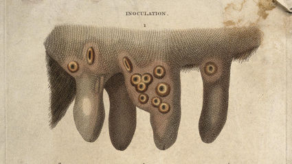 Ubres de vaca con pústulas de viruela