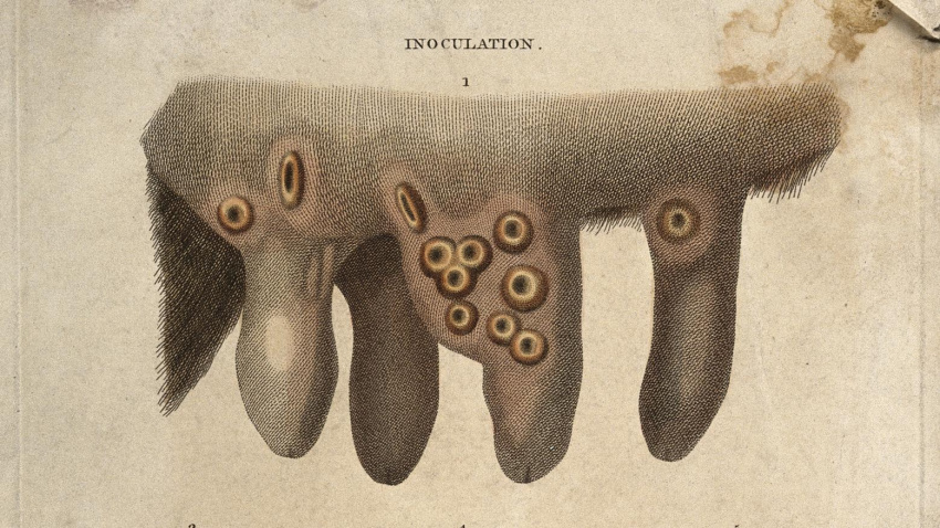 Ubres de vaca con pústulas de viruela