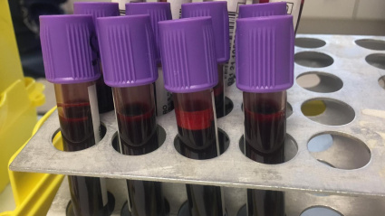 Tubos de extracción de sangre