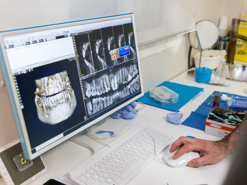 Dentista examinando la radiografía de un paciente en la pantalla de la computadora.