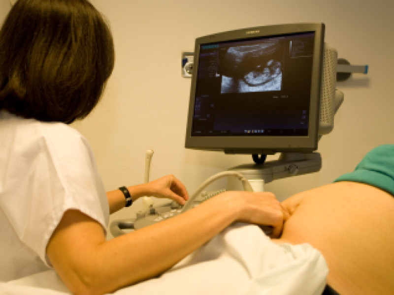 Pronunciamento "favorable" de la Junta al registro de objetores de conciencia por el aborto