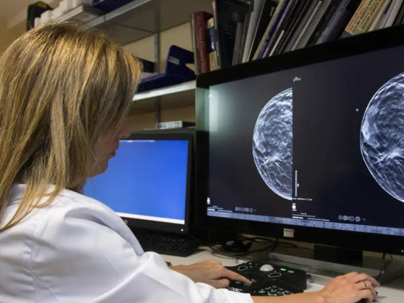Una doctora muestra una mamografía con fotosíntesis