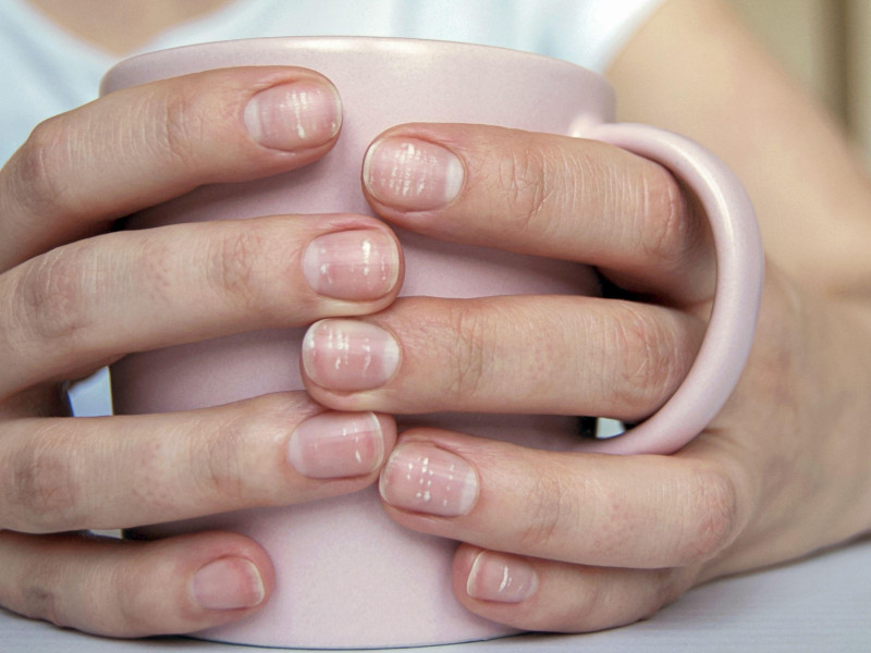 Una mujer sostiene una taza con unas manos con rayas en las uñas