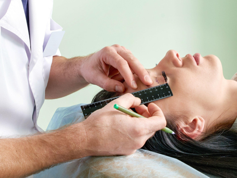 Cirujano plástico y mujer joven con líneas de corrección antes de la cirugía estética, dibujando líneas en los ojos.