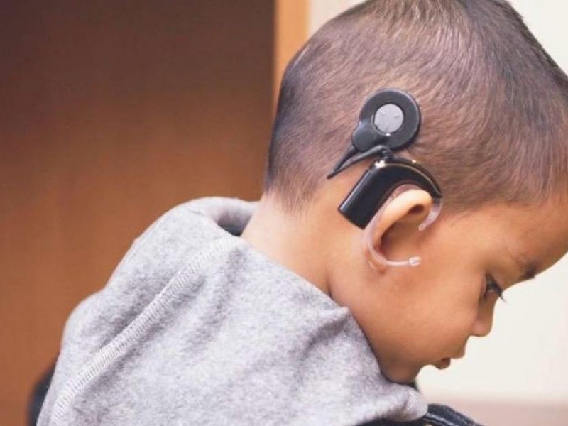 Niño pequeño con un implante coclear