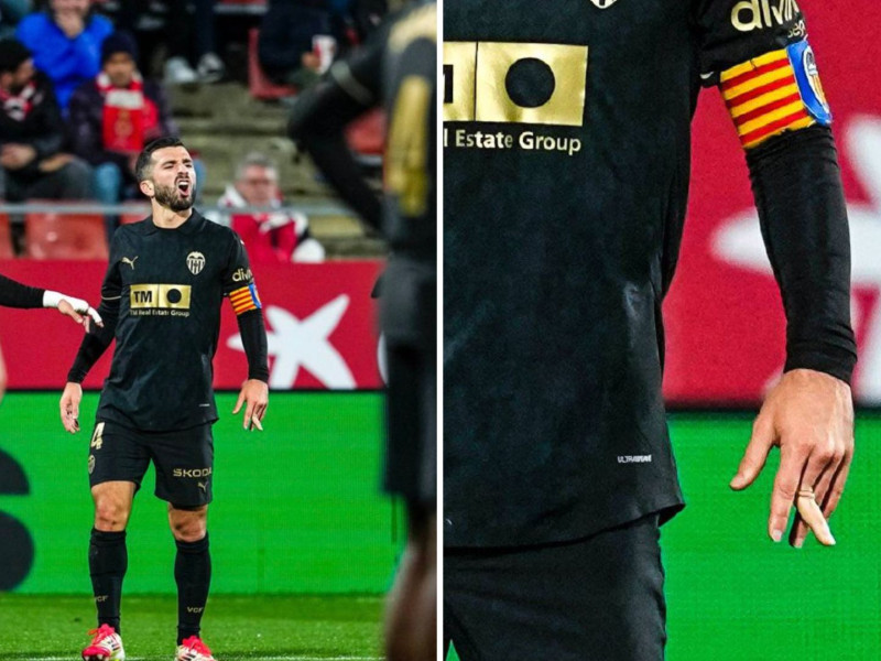 Así quedó el dedo de Gayá, en el partido contra el Girona