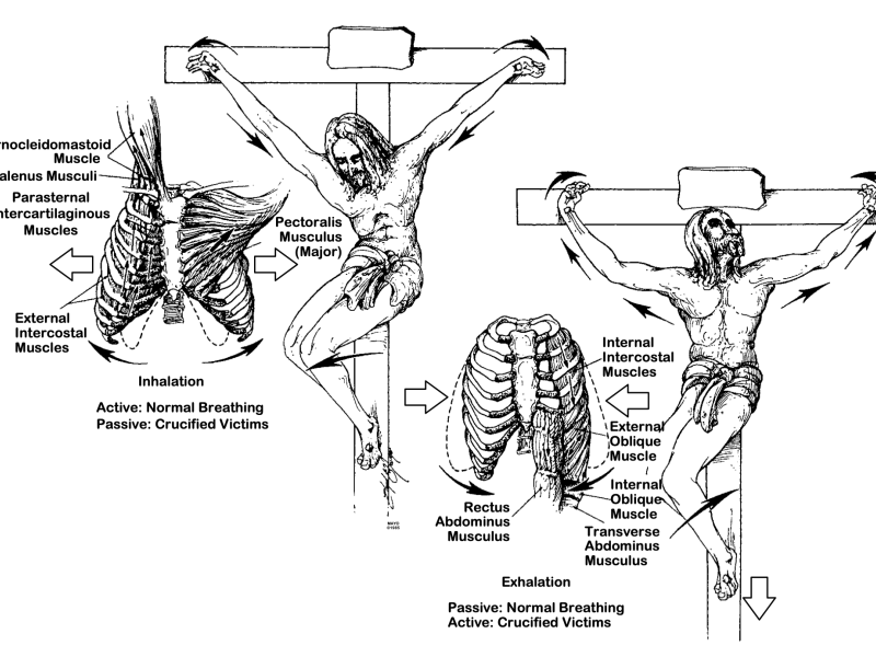 Ilustración que acompaña al informe 'On the Physical Death of Jesus Christ'