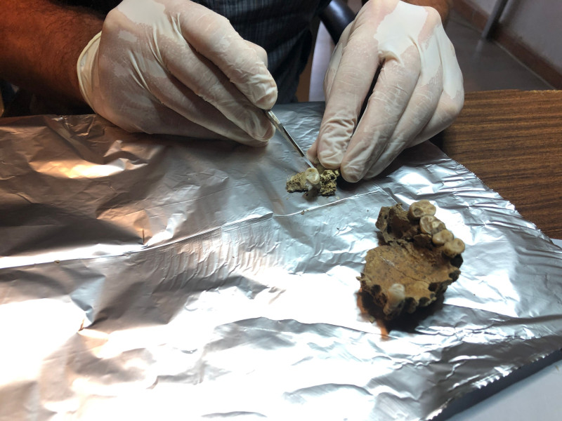 Preparación de muestras recogidas en el estudio