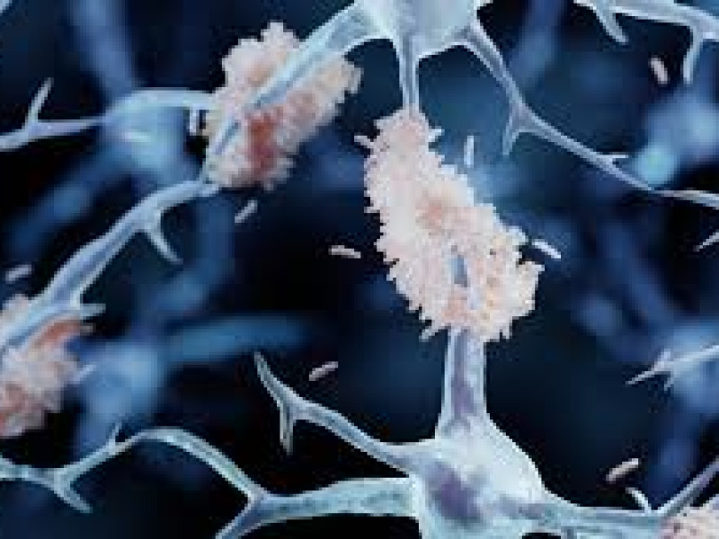 Neuronas