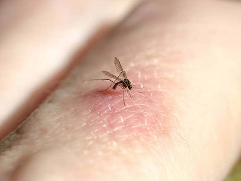 Picadura de mosquito tigre