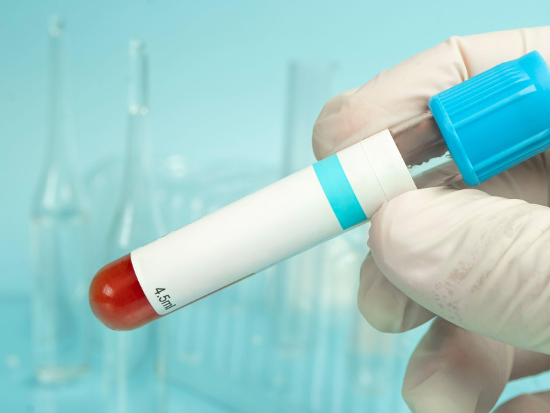 Primer plano de la mano de un profesional médico sosteniendo un tubo de ensayo de sangre con una etiqueta de maqueta vacía sobre fondo azul, composición bioquímica del paciente.