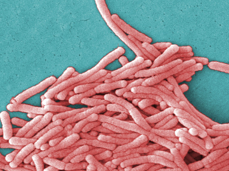 La Legionella se combate con muy altas temperaturasUnder a moderately-high magnification of 8000X, this colorized scanning electron micrograph (SEM) depicted a large grouping of Gram-negative <i>Legionella pneumophila</i> bacteria. Please see PHIL 11092 through 11154 for additional SEMs of these organisms, specifically PHIL 11149 for a black and white version of this image. Of particular importance, is the presence of polar flagella, and pili, or long streamers, which due to their fragile nature, in some of these views seem to be dissociated from any of the bacteria. You’ll note that a number of these bacteria seem to display an elongated-rod morphology. <i>L. pneumophila</i> are known to most frequently exhibit this configuration when grown in broth, however, they can also elongate when plate-grown cells age, as it was in this case, especially when they’ve been refrigerated. The usual <i>L. pneumophila</i> morphology consists of stout, “fat” bacilli, which is the case for the vast majority of the organisms depicted here. These bacteria originated on a 1 week-old culture plate (+/- 1 day), which had incubated a single colony, at 37<sup>?</sup>C upon a buffered charcoal yeast extract (BCYE) medium with no antibiotics.