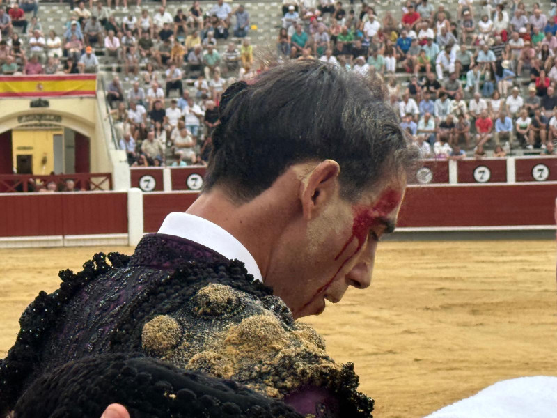 El cuarto de la tarde dejó así la cara de Saúl Jiménez Fortes