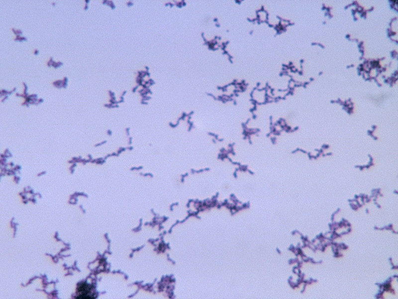 02/72Bobby StrongThis micrograph depicts the gram-positive bacterium <i>Propionibacterium acnes</i> grown in thioglycollate medium at 48 hours.<i>Propionibacterium acnes</i> is a very common obligate anaerobic, non-spore forming rod, is the etiologic pathogen responsible for acne vulgaris, or pimples. It normally resides in the sebaceous glands of the skin.