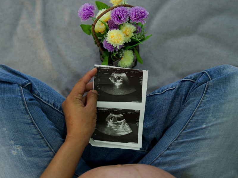 Asociaciones provida analizan los datos de aborto de España