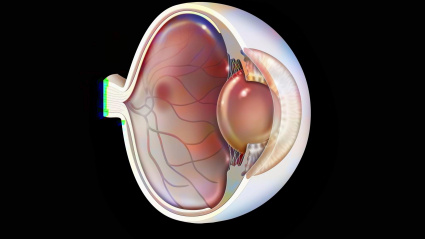 Ojo: degeneración macular relacionada con la edad (enfermedad degenerativa de la mácula).