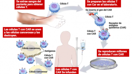 Tratamiento CAR-T