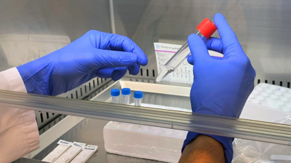 (Foto de ARCHIVO)Los hospitales Quirónsalud de Andalucía incorporan la PCR con muestra en saliva para detección de Covid-19REMITIDA / HANDOUT por QUIRÓNSALUDFotografía remitida a medios de comunicación exclusivamente para ilustrar la noticia a la que hace referencia la imagen, y citando la procedencia de la imagen en la firma27/11/2020