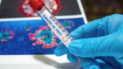 (Foto de ARCHIVO)Covid en base de datosREMITIDA / HANDOUT por UVFotografía remitida a medios de comunicación exclusivamente para ilustrar la noticia a la que hace referencia la imagen, y citando la procedencia de la imagen en la firma02/4/2025