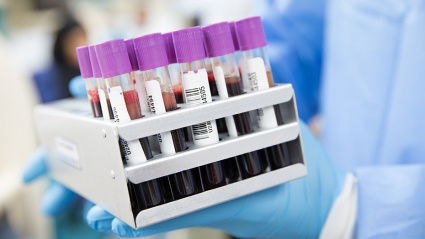 (Foto de ARCHIVO)Análisis de sangre. (Foto de recurso).REMITIDA / HANDOUT por JUNTA DE ANDALUCÍAFotografía remitida a medios de comunicación exclusivamente para ilustrar la noticia a la que hace referencia la imagen, y citando la procedencia de la imagen en la firma17/4/2025