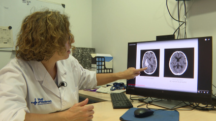 (Foto de ARCHIVO)'Venciendo Al Ictus', Esta Semana En 'Repor'Europa Press18/10/2024