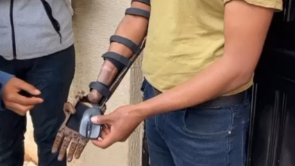 Uno de los beneficiados por las prótesis de Guillermo