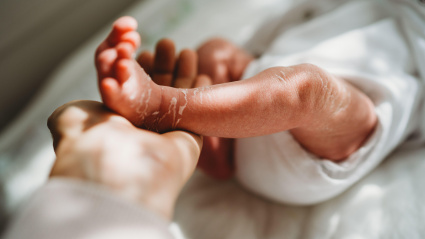 Mano de mamá sosteniendo los pies de un bebé recién nacido con la piel descamada