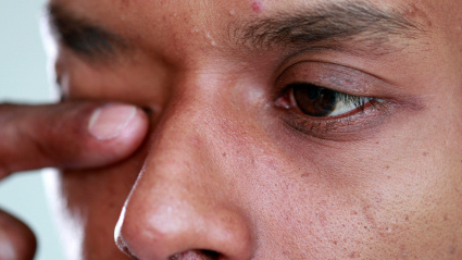 Hombre tocándose la cara y frotándose el ojo con el dedo y la mano