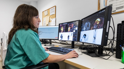 aspanoa cancer aragon