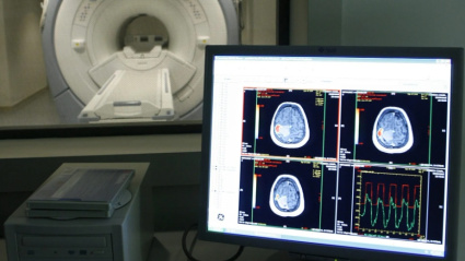 Vista de un escáner en un centro de tratamiento de Alzheimer. EFE/Sergio Barrenechea