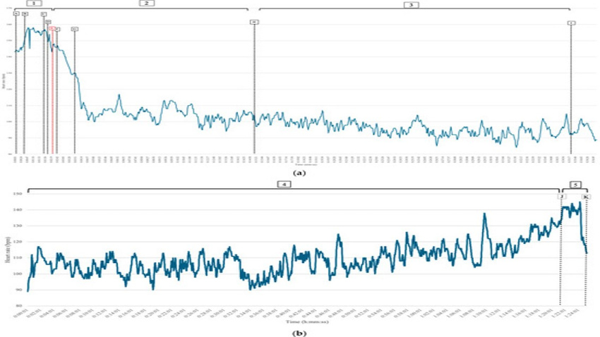 Medicines de la intensidad fisiológica medida en Manuel Caballero