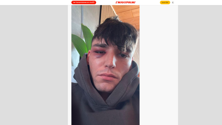 La imagen del árbitro Pascar Kaiser tras la agresión