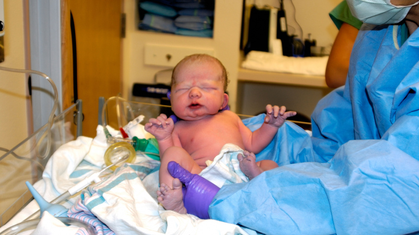 Cuidados posparto de un niño nacido por cesárea