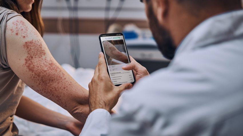 Legit.Health y su modelo de IA para detectar cáncer de piel