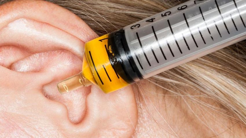 Los tapones de cera pueden comprometer la audición