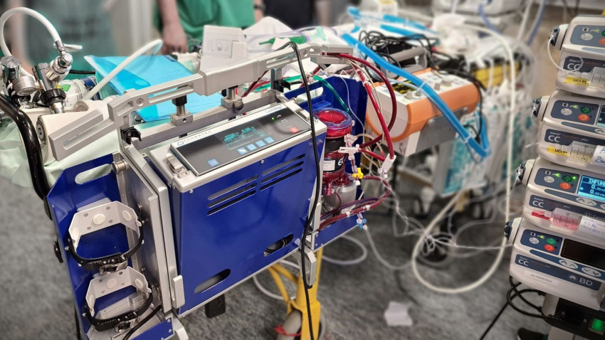 El sistema ECMO en el hospital de Santiago de Compostela