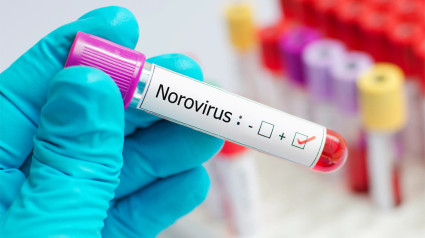 Norovirus