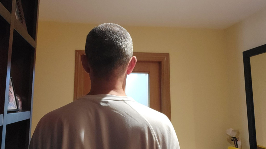 Florentino, médico agredido en Plasencia