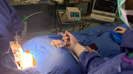 Cirugía de Tiroides en Santa Lucía