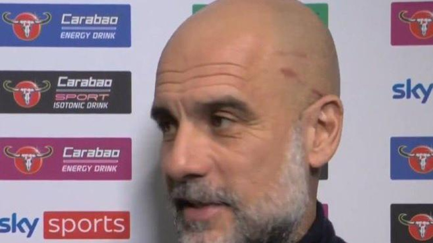 Guardiola vuelve a aparecer con arañazos en la cabeza