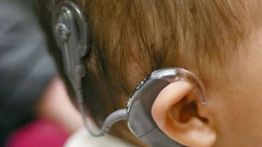 Implante coclear en bebés