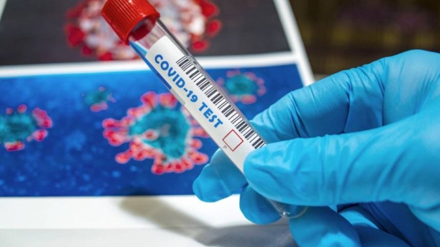 (Foto de ARCHIVO)Covid en base de datosREMITIDA / HANDOUT por UVFotografía remitida a medios de comunicación exclusivamente para ilustrar la noticia a la que hace referencia la imagen, y citando la procedencia de la imagen en la firma02/4/2025