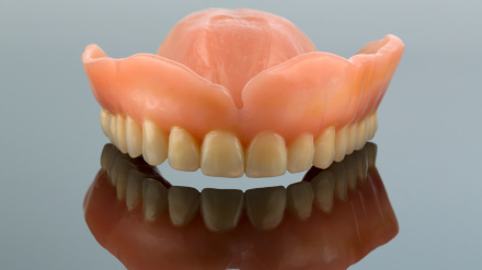 Fotografía de archivo de una prótesis dental