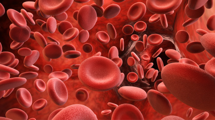 Una proteína abre una nueva vía para predecir y tratar el ictus