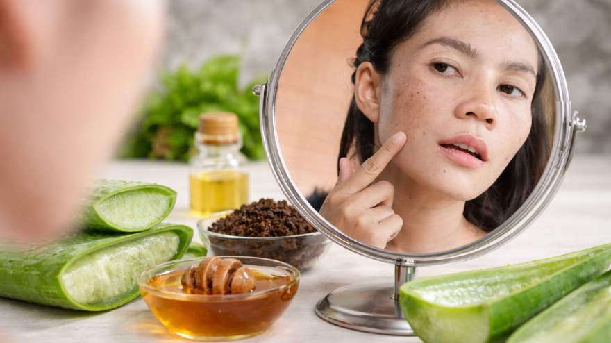 Cómo reducir las manchas solares