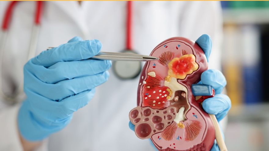 Enfermedades renales