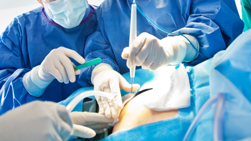 Médicos practicando una cesárea